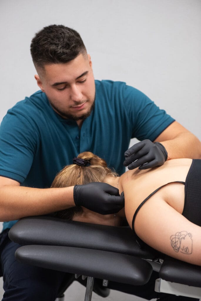 Igłoterapia mięśnia czworobocznego