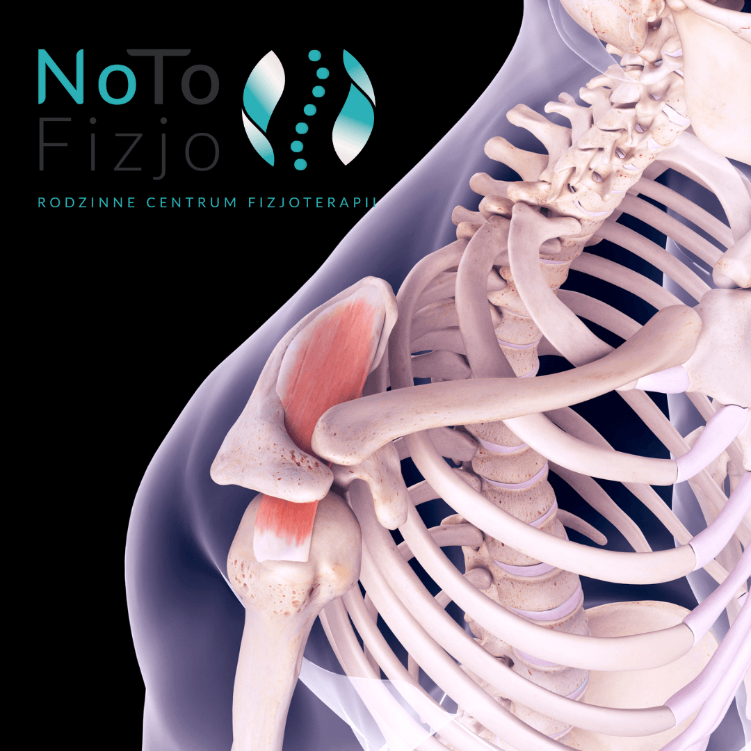 You are currently viewing Tendinopatia mięśnia nadgrzebieniowego – Fizjoterapia | Zabrze