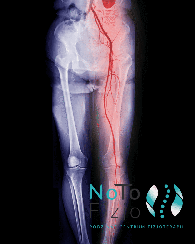 Rwa udowa diagnostyka