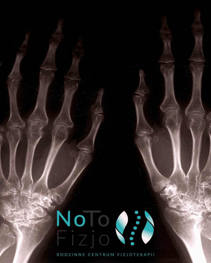 RZS - diagnostyka obrazowa