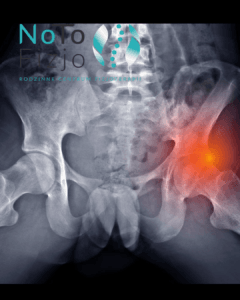 Read more about the article Konflikt panewkowo-udowy | FIZJOTERAPIA BYTOM