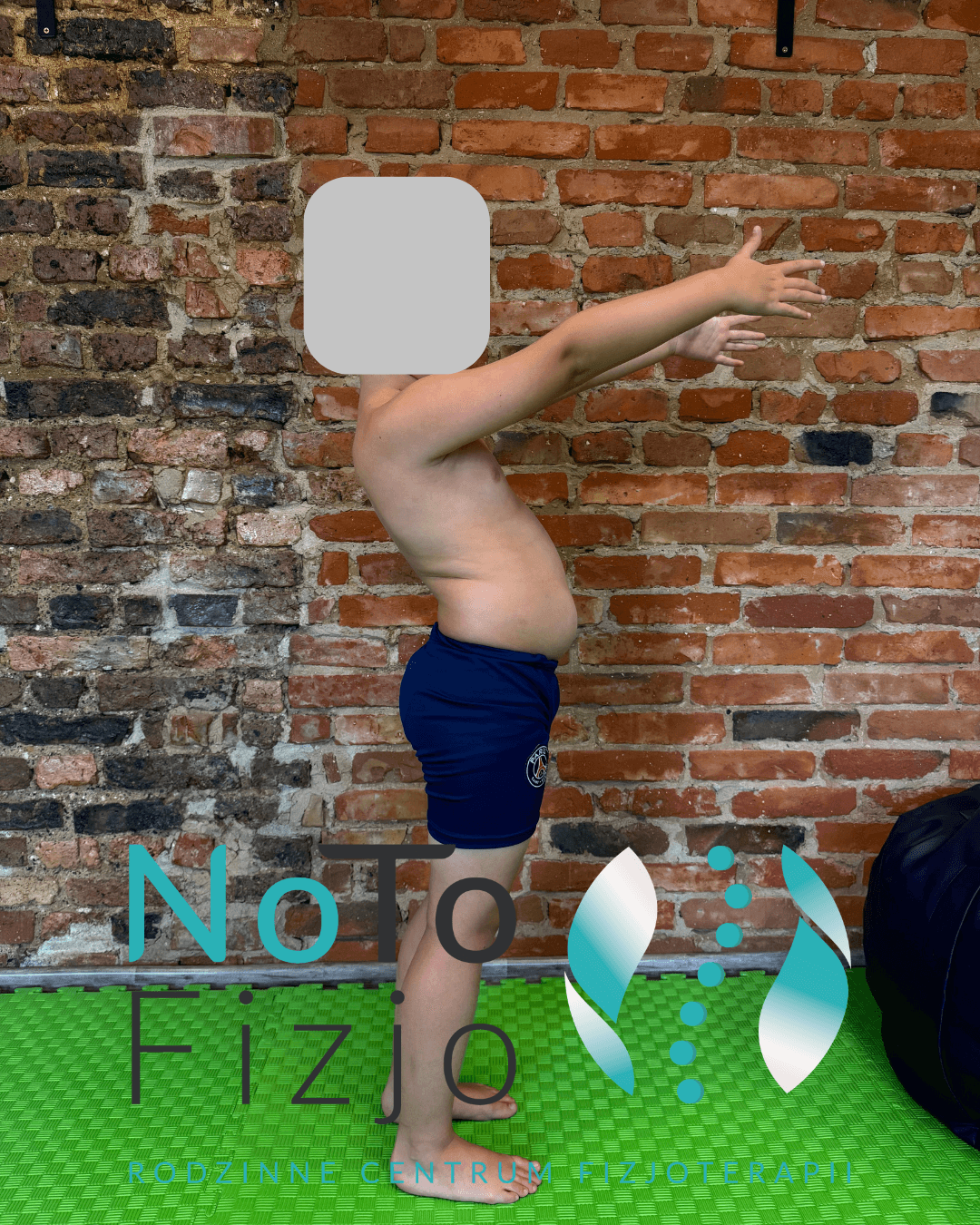 You are currently viewing Zespół skrzyżowania dolnego – Fizjoterapia ZABRZE