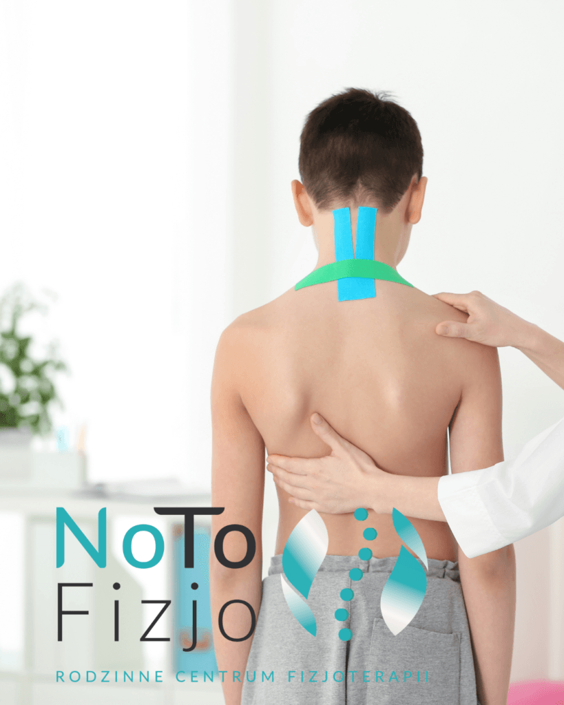 Odstające łopatki fizjoterapia