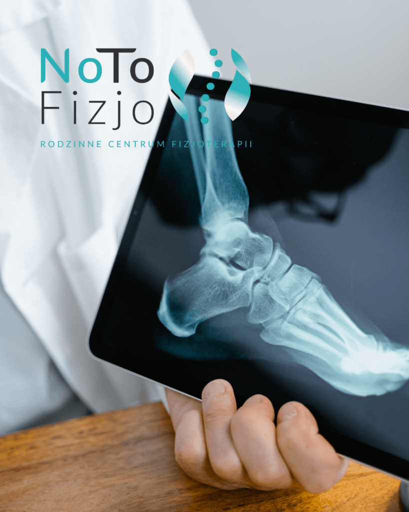 Skręcenie kostki diagnostyka