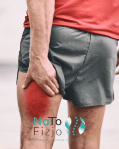 Read more about the article Naciągnięcie mięśnia – Fizjoterapia BYTOM