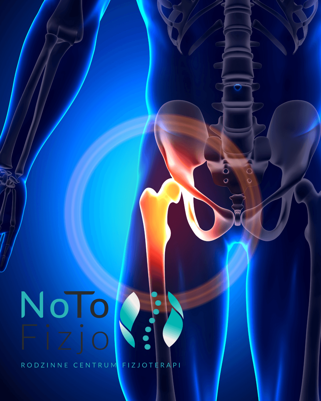 You are currently viewing Rehabilitacja biodra – jak pozbyć się bólu biodra? Fizjoterapia BYTOM