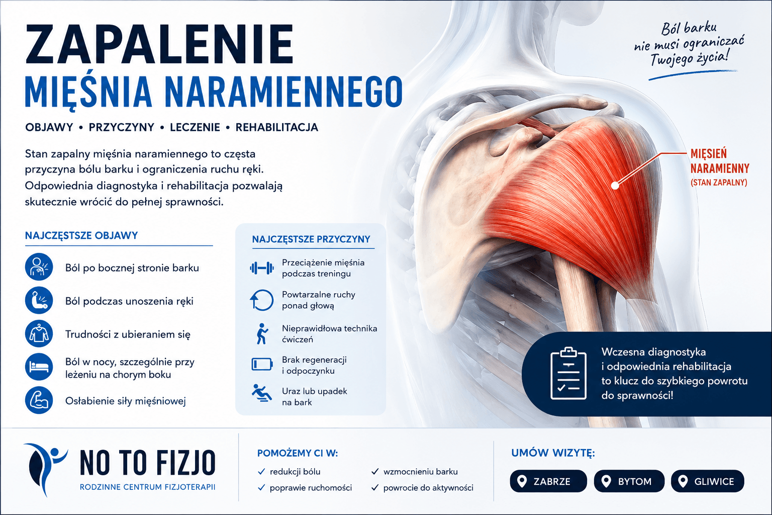 You are currently viewing Zapalenie mięśnia naramiennego – objawy, leczenie i rehabilitacja | No To Fizjo Zabrze