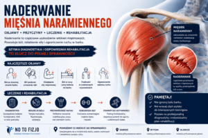 Read more about the article Naderwanie mięśnia naramiennego – objawy, leczenie i rehabilitacja | Fizjoterapeuta Zabrze