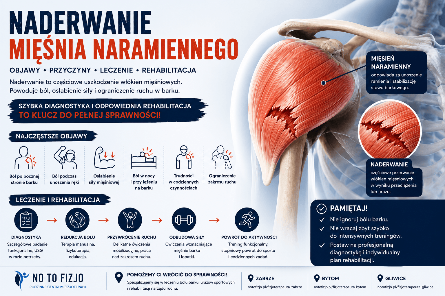 You are currently viewing Naderwanie mięśnia naramiennego – objawy, leczenie i rehabilitacja | Fizjoterapeuta Zabrze