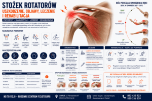 Read more about the article Stożek rotatorów – uszkodzenie, objawy i leczenie | Fizjoterapeuta Zabrze