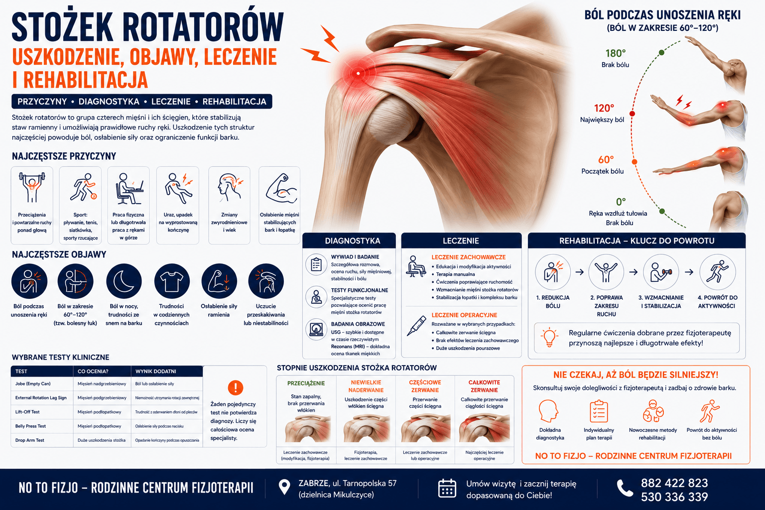You are currently viewing Stożek rotatorów – uszkodzenie, objawy i leczenie | Fizjoterapeuta Zabrze