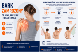 Read more about the article Bark zamrożony – objawy, leczenie i rehabilitacja | Rehabilitacja Zabrze