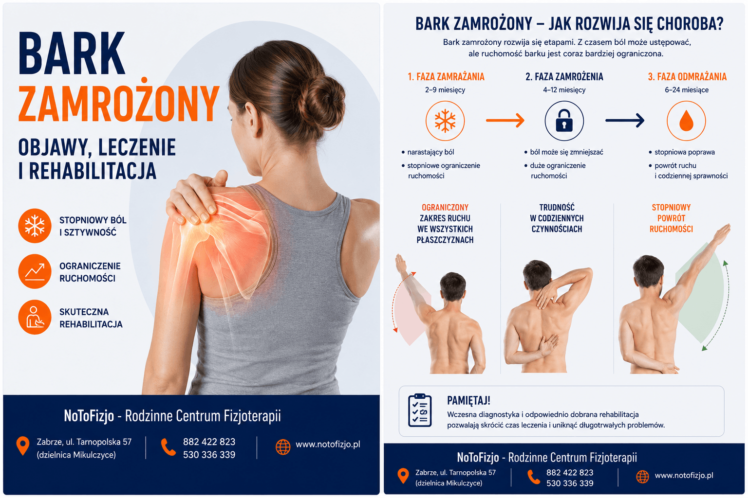 You are currently viewing Bark zamrożony – objawy, leczenie i rehabilitacja | Rehabilitacja Zabrze