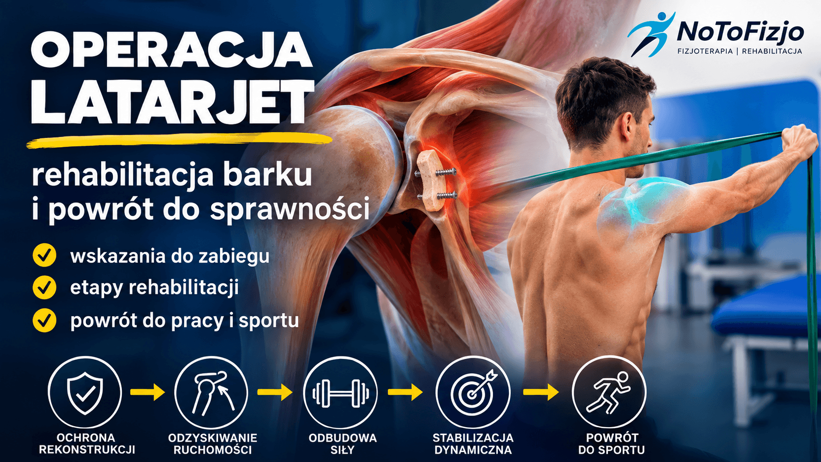 You are currently viewing Operacja Latarjet – wskazania, rehabilitacja i powrót do sportu | Fizjoterapeuta Gliwice