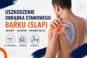 Read more about the article Uszkodzenie obrąbka stawowego barku (SLAP) – objawy, leczenie i rehabilitacja | Fizjoterapia Zabrze