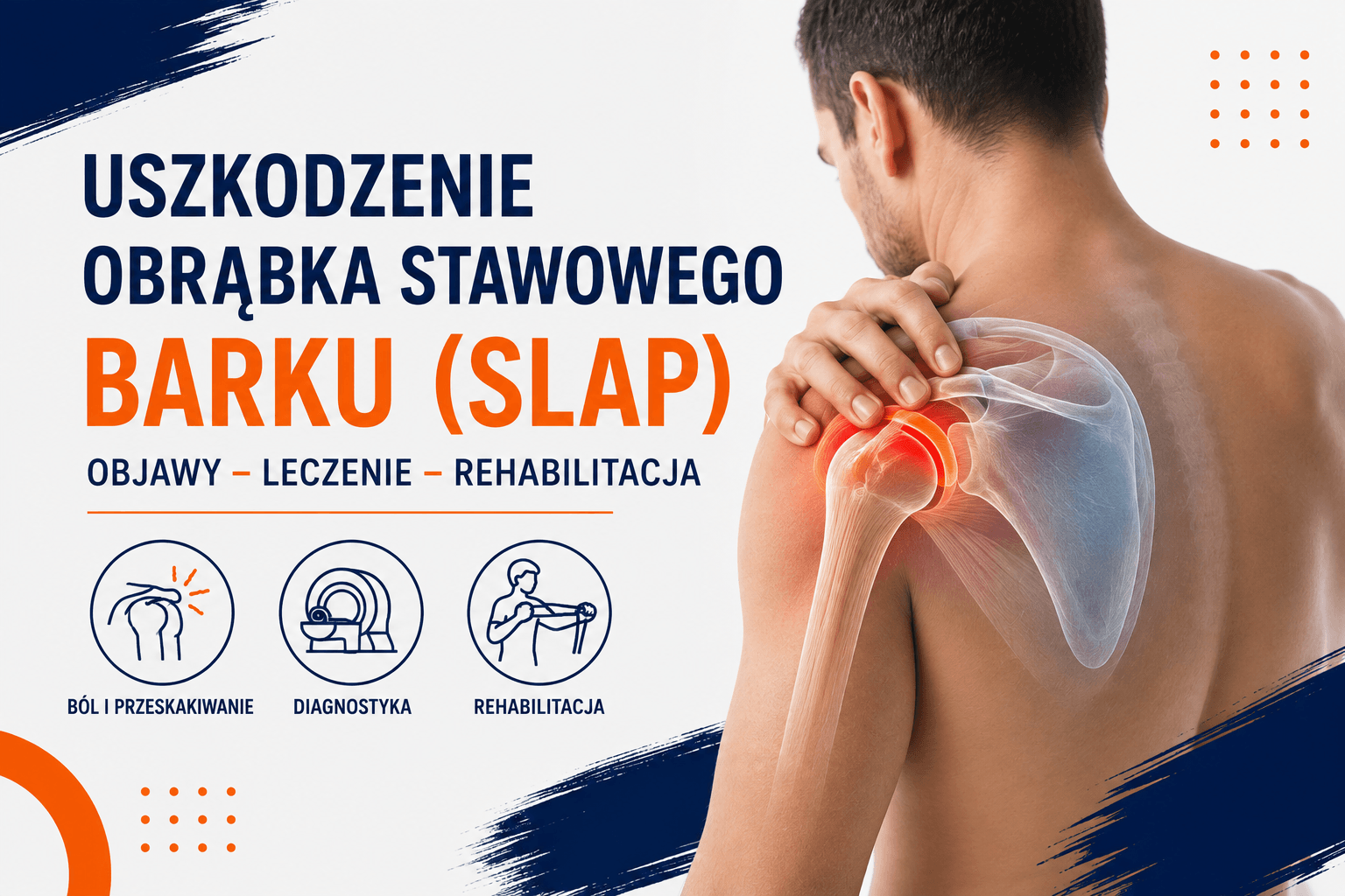 You are currently viewing Uszkodzenie obrąbka stawowego barku (SLAP) – objawy, leczenie i rehabilitacja | Fizjoterapia Zabrze