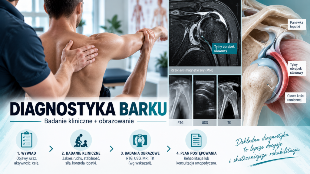 Diagnostyka niestabilności tylnej barku – badanie kliniczne i rezonans stawu ramiennego