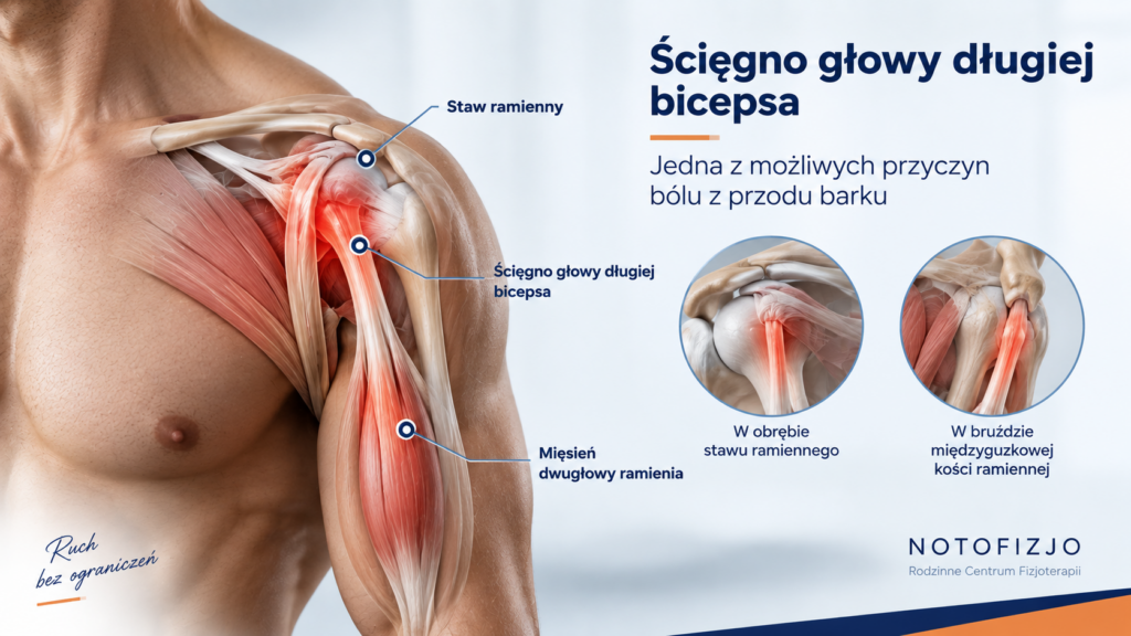 Ścięgno głowy długiej bicepsa jako możliwe źródło bólu.