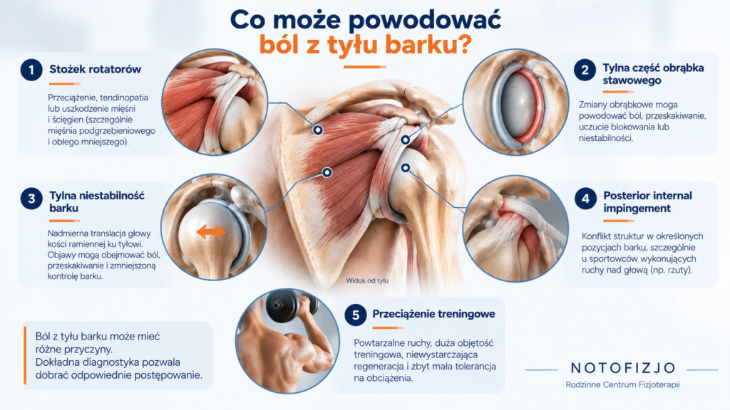 Przyczyny bólu z tyłu barku – stożek rotatorów, obrąbek i tylna niestabilność