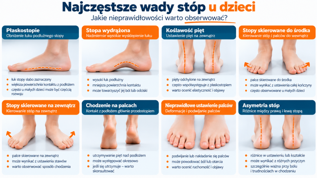 Najczęstsze wady stóp u dzieci – płaskostopie, stopa wydrążona, koślawość pięt, ustawienie stóp do środka i na zewnątrz oraz chodzenie na palcach